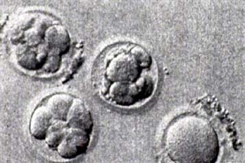 Συνθήκη για την απαγόρευση του κλωνισμού ανθρώπων θα συντάξει ο ΟΗΕ