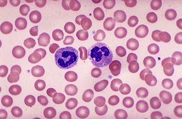 Τα  βλαστικά κύτταρα των ενηλίκων ίσως δεν έχουν θεραπευτικές δυνατότητες