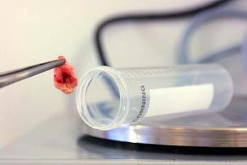 Καθησυχαστικοί οι επιστήμονες για την επιδημία μετά τη σύσκεψη του ΚΕΕΛ