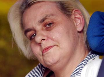 Απέρριψε το ΕΔΑΔ την αίτηση της παράλυτης Βρετανίδας να βάλει τέλος στη ζωή της