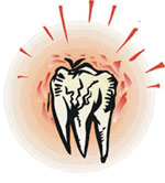 Οι επιστήμονες βρίσκονται ένα βήμα πριν από την κυκλοφορία εμβολίου κατά της τερηδόνας