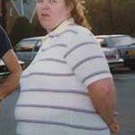 Οι μεταβολές του σωματικού βάρους προδιαθέτουν στην εμφάνιση καρδιακής ανεπάρκειας