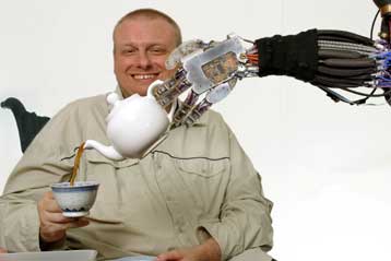 Τεχνητός βραχίονας για τη βοήθεια ατόμων με κινητικά προβλήματα