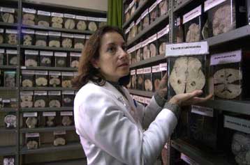 Ελβετοί επιστήμονες εξηγούν γιατί τελικά ξεχνάμε όσα θα θέλαμε πολύ να θυμόμασταν…