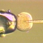 Την έγκριση της Βρετανικής Βουλής αναμένει η μεγαλύτερη βιοτράπεζα στον κόσμο