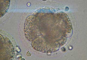 Κατατέθηκε η αίτηση του Ινστιτούτου Ρόσλιν για τον κλωνισμό ανθρώπινων εμβρύων