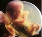 Τα πρωτεία κατέχει η Ελλάδα στις εκτρώσεις