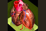Η εμβρυϊκή αιματική κυκλοφορία επηρεάζει το σχηματισμό της καρδιάς