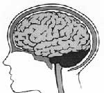 Με τρεις απλές ερωτήσεις μπορείτε να διαγνώσετε το εγκεφαλικό επεισόδιο