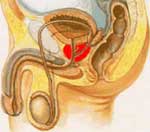 Η συχνή εκσπερμάτωση δεν προφυλάσσει από υπερπλασία του προστάτη
