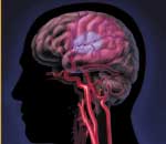 Νέο θεραπευτικό σχήμα περιορίζει τις βλάβες του εγκεφαλικού επεισοδίου