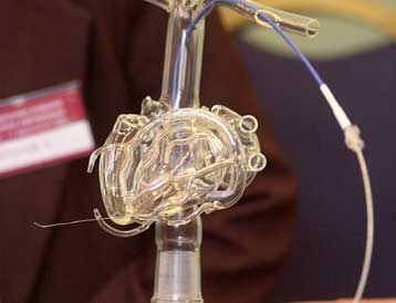 Έλληνες επιστήμονες εντόπισαν το γονίδιο που ευθύνεται για τις καρδιακές ανεπάρκειες