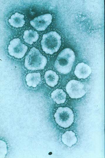 Τι είναι ο φοβερός «κορονοϊός», ποια η προέλευσή του και γιατί μας ανησυχεί τόσο