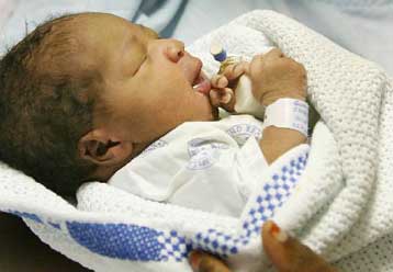 Στη Ν.Αφρική το τέταρτο βρέφος παγκοσμίως που επιβιώνει από εξωμήτριο κύηση