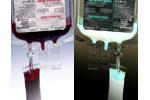 Μετάγγιση αίματος: Η νέα μορφή ντόπινγκ