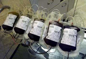 Ασθενείς καταθέτουν μήνυση στις ΗΠΑ  για τη διάθεση προϊόντων από μολυσμένο αίμα