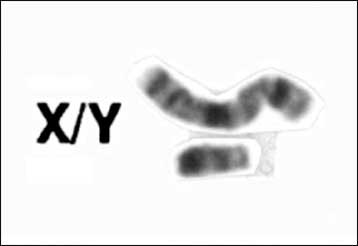 Εκπλήξεις κρύβει η πλήρης αλληλουχία του ανδρικού χρωμοσώματος Υ
