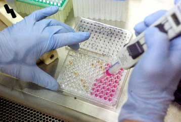 Γονίδιο αυξάνει τον κίνδυνο κατάθλιψης έπειτα από τραυματικά γεγονότα