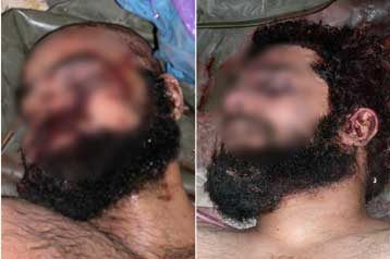 Στη δημοσιότητα οι φωτογραφίες των νεκρών Ουντάι και Κουσάι Χουσεΐν