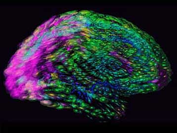 Ερευνητική κοινοπραξία δημοσιεύει ψηφιακό χάρτη του εγκεφάλου