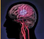 Το εγκεφαλικό επεισόδιο αιτία θανάτου πέντε εκατομμυρίων ατόμων ετησίως