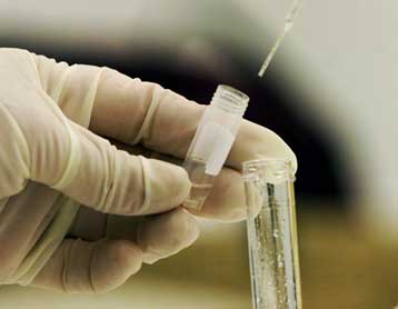 Πειραματικό φάρμακο καταπολεμά αποτελεσματικά την ηπατίτιδα C