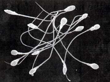 Προς απαγόρευση στη Βρετανία η επιλογή φύλου για κοινωνικούς λόγους