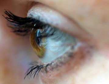 Λύση στα προβλήματα όρασης με εμφύτευση μονίμων φακών επαφής