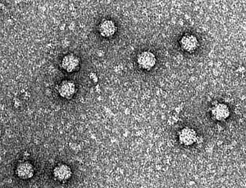 Ο Κρεγκ Βέντερ παρουσιάζει τον πρώτο ιό με συνθετικά γονίδια