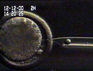 Διχασμένη η Κομισιόν για τη χρηματοδότηση ερευνών σε ανθρώπινα έμβρυα