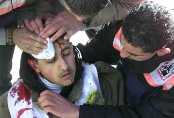 Ένας νεκρός και 17 τραυματίες σε συγκρούσεις Ισραηλινών-Παλαιστινίων στη Ναμπλούς