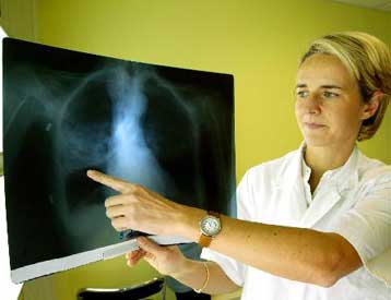 Τρία εργοστάσια κλειστά στη Γαλλία λόγω έξαρσης της νόσου των λεγεωνάριων