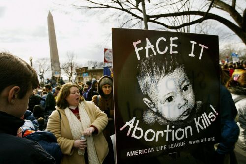 Σε υπερηχογράφημα υποχρεώνει το Τέξας τις εγκύους για να αποτρέψει τις αμβλώσεις