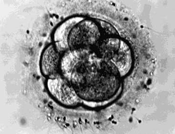 Έμβρυα που καταψύχθηκαν πριν από 12 χρόνια αναπτύσσονται σε υγιή βρέφη