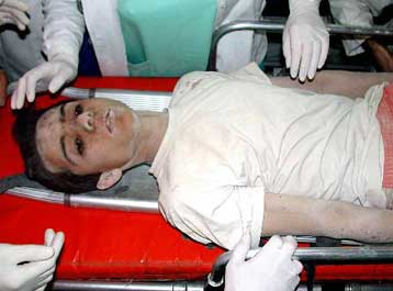 Νεαρός βρέθηκε ζωντανός στα ερείπια του κτιρίου που κατέρρευσε στο Ικόνιο