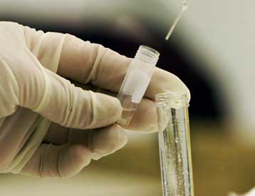 Γενετική θεραπεία μειώνει δραστικά το σωματικό λίπος σε πειραματόζωα