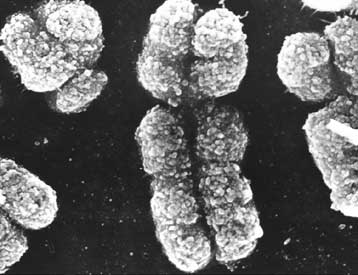 Ένα βήμα πιο κοντά στα γονίδια της γήρανσης