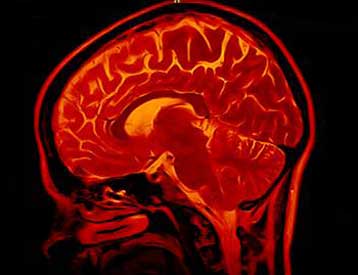 Μέθοδος ανίχνευσης του ψεύδους στον εγκέφαλο δοκιμάζεται σε δικαστήριο των ΗΠΑ