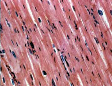 Το πρώτο ρομπότ με μύες αρχίζει να περπατά