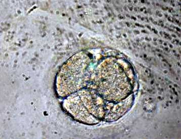 Έμβρυα δημιουργούνται για πρώτη φορά από κατεψυγμένες ωοθήκες