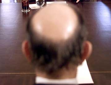 Σε θεραπεία για τη φαλάκρα ίσως οδηγήσει έρευνα με βλαστικά κύτταρα