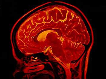 To «σημειωματάριο» του εγκεφάλου έχει μέγεθος κέρματος