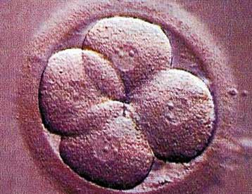 Η πρώτη στον κόσμο τράπεζα βλαστικών κυττάρων εγκαινιάζεται στη Βρετανία