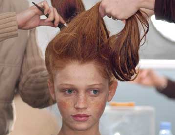 Γονίδιο τιθασσεύει τα μαλλιά και εμποδίζει την τριχοφυία στις πατούσες