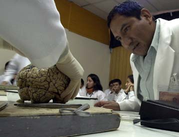 Λύση στο μυστήριο της εγκεφαλίτιδας που σκότωσε ένα εκατομμύριο ανθρώπους το 1920