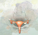 Νέο διαγνωστικό τεστ για την πρώιμη ανίχνευση του καρκίνου των ωοθηκών