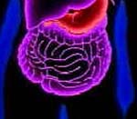 Νέο, πιο ακριβές, διαγνωστικό τεστ για το καρκίνο του εντέρου