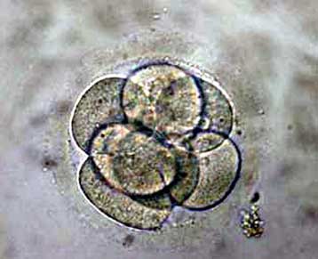 Πρώτη άδεια για έρευνες με κλωνοποιημένα έμβρυα στην Ευρώπη