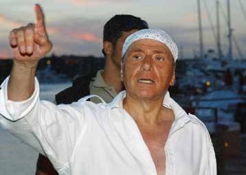 Μετά το λίφτινγκ και μεταμόσχευση μαλλιών για τον Σίλβιο Μπερλουσκόνι;