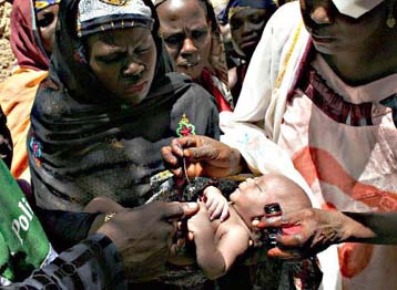 Αντιμέτωπη με την απειλή της πολιομυελίτιδας και πάλι η Αφρική, προειδοποιεί ο ΠΟΥ